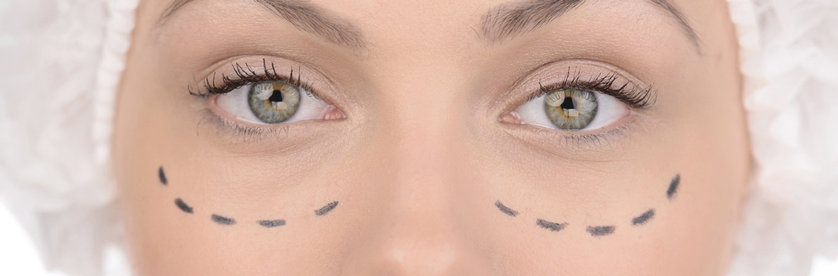canthopexy canthopexy auckland plastic surgical centre